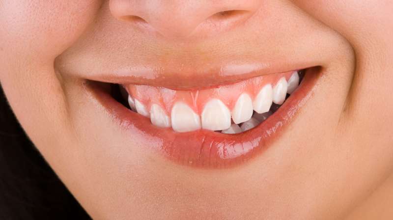 Transform Your Gummy Smile with Dr. Mark