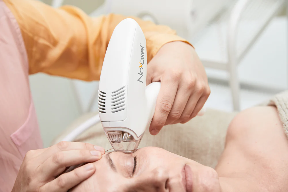 Mezotix Pigmentation Treatment